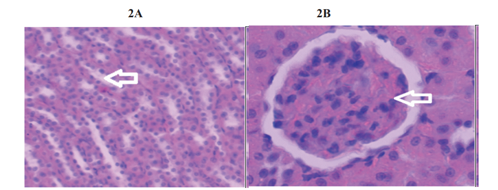 Normal renal tubules and normal glomerulus of kidneys from rats not induced with Cisplatin