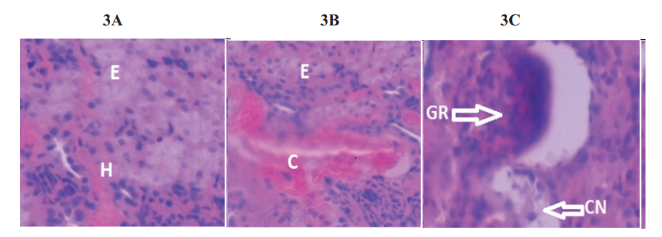 Nephrotoxic effects of Cisplatin on interstitium, renal tubules, and glomerulus of kidneys from induced rats.