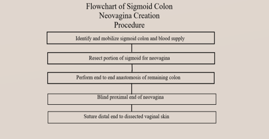 flowchart of sigmoid colon
