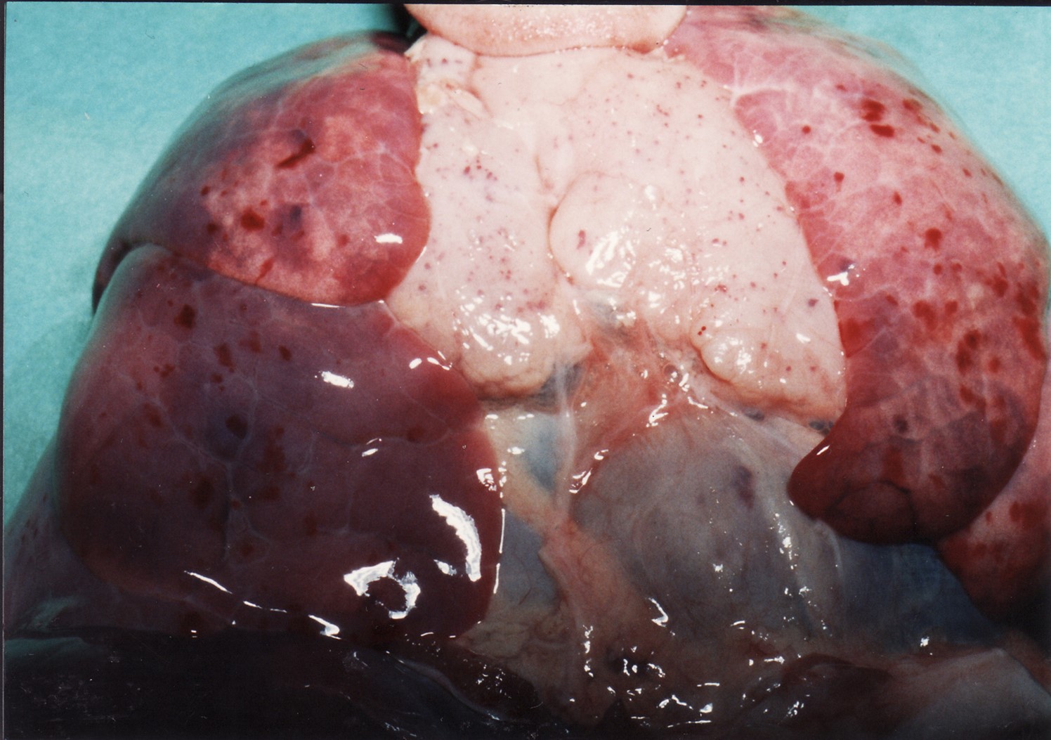 Fig. 4 Petechial haemorrhages over thymus gland and pleural surface