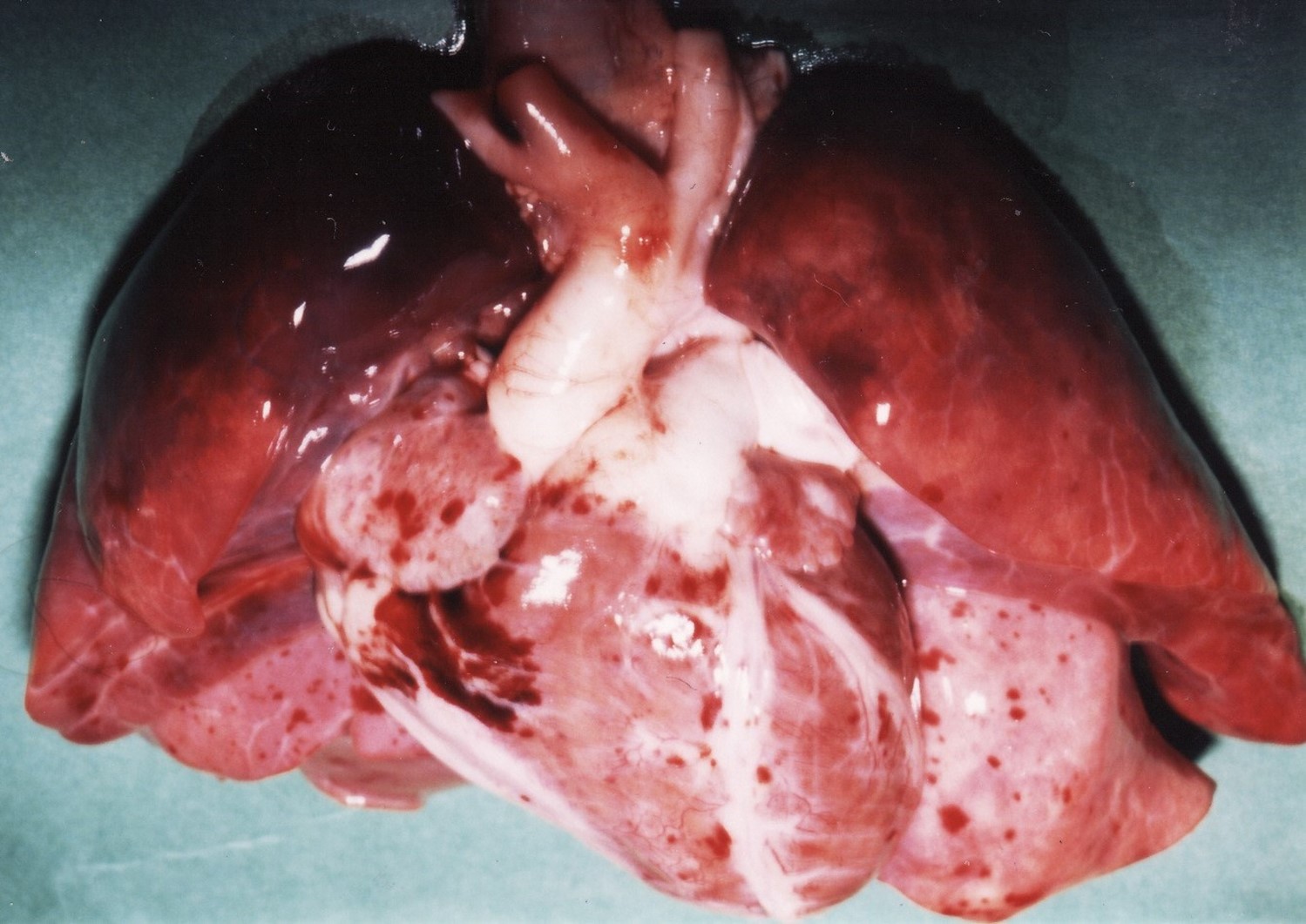 Fig. 5 Confluent petechiae over epicardial surface